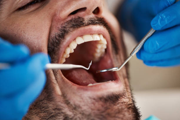 Best Weekend Emergency Dentist in Banks Springs, LA