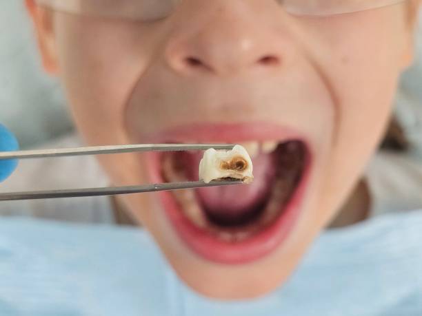 Best Cosmetic Emergency Dentistry in Banks Springs, LA