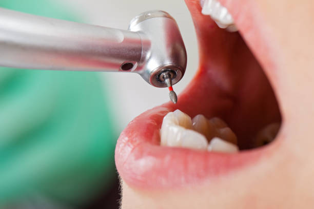 Best Emergency Gum Treatment in Banks Springs, LA
